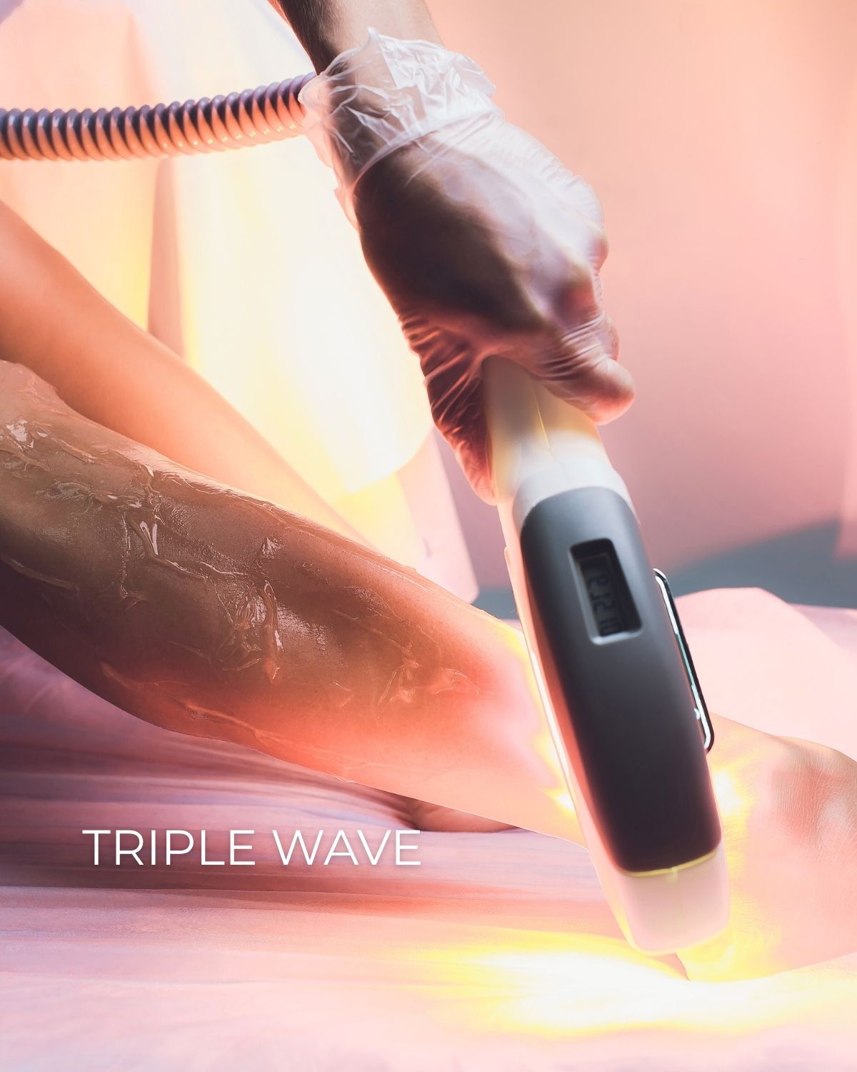 Triple Wave varanleg háreyðing